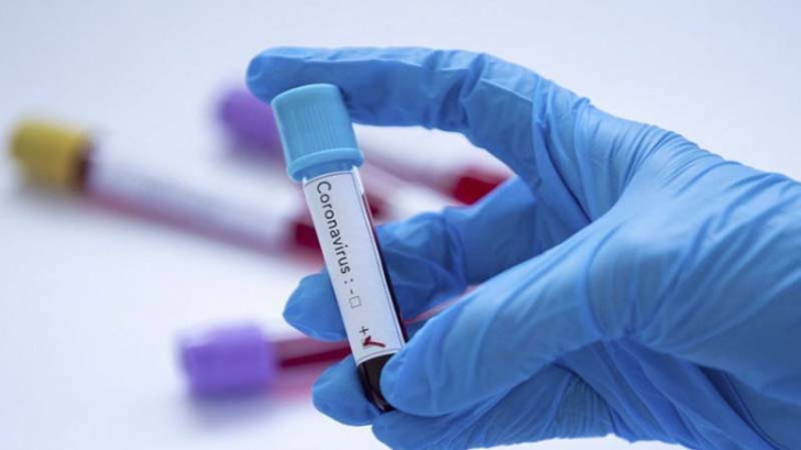 Daha 367 nəfərdə koronavirus aşkarlandı: 3 pasiyent vəfat etdi