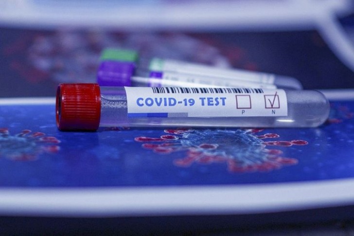 Azərbaycanda indiyədək 1523221 koronavirus testi aparılıb