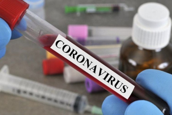 Rusiyada son sutkada 21 734 nəfər koronavirusa yoluxub