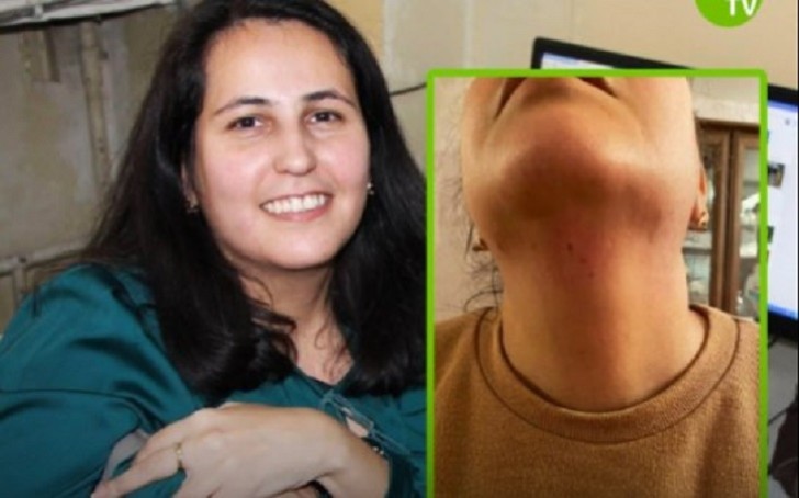 Jurnalist Aytən Məmmədova bıçaqlı hücuma məruz qaldı: