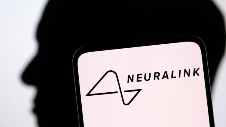 "Neuralink"in beyninə çip qoyduğu ilk insan düşünərək siçan kursorunu hərəkət etdirə bilib