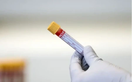 İşə qəbulda narkoloji rəy təqdim ediləcək