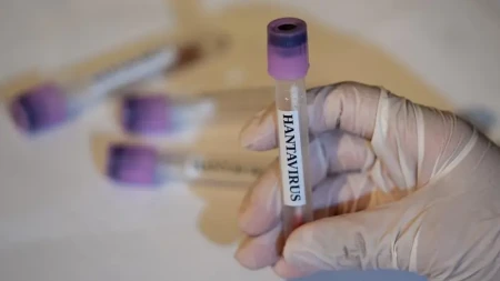 ÜST: Hantavirus yeni bir pandemiyanın başlanğıcı deyil