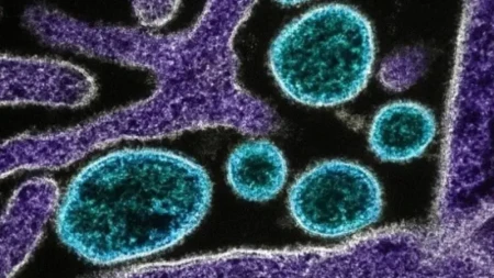 ÜST: Atlantik okeanındakı gəmidə 7 hantavirus yoluxması müəyyən edilib