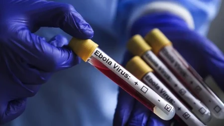 Konqo Demokratik Respublikasında Ebola epidemiyasında ölənlərin sayı 1405-ə yüksəlib