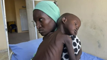 Nigeriyada 17 milyondan çox insan aclıq təhlükəsi ilə üz-üzədir