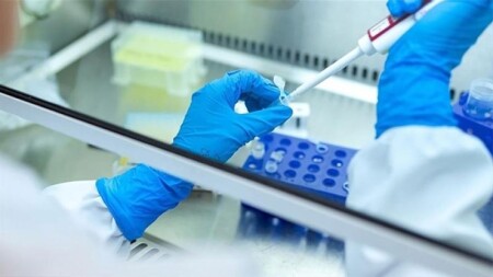 Rusiyada vəba laboratoriyası əməkdaşının ölümü ilə bağlı açıqlama verildi