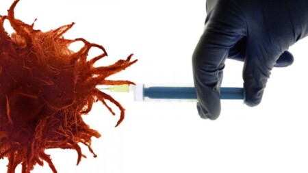 mRNA peyvəndi dəri xərçənginin təkrarlanma riskini 42% azaldır